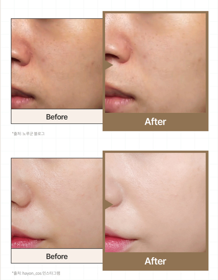 Klairs Illuminating Supple Blemish Cream Before and After — real influencer results